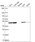 Annexin A7 Antibody in Western Blot (WB)