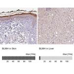 BLMH Antibody