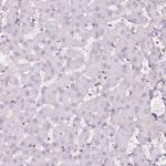 BLMH Antibody in Immunohistochemistry (Paraffin) (IHC (P))