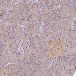 BLMH Antibody in Immunohistochemistry (Paraffin) (IHC (P))