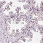 BLMH Antibody in Immunohistochemistry (Paraffin) (IHC (P))