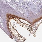 BLMH Antibody in Immunohistochemistry (Paraffin) (IHC (P))