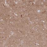 SPRED2 Antibody in Immunohistochemistry (Paraffin) (IHC (P))