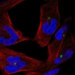 CEP290 Polyclonal Antibody