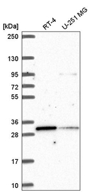 MLX Antibody in Western Blot (WB)