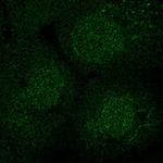 SEC14L2 Polyclonal Antibody