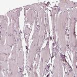 Syntenin 2 Polyclonal Antibody