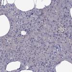 CDK5 Antibody in Immunohistochemistry (Paraffin) (IHC (P))