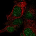 LYSMD1 Polyclonal Antibody