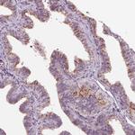 IL9R Antibody in Immunohistochemistry (Paraffin) (IHC (P))