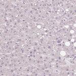 IL9R Antibody in Immunohistochemistry (Paraffin) (IHC (P))