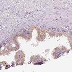 IL9R Antibody in Immunohistochemistry (Paraffin) (IHC (P))