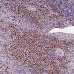 IL9R Polyclonal Antibody