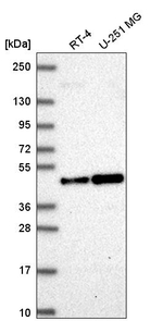 ORC4 Antibody in Western Blot (WB)