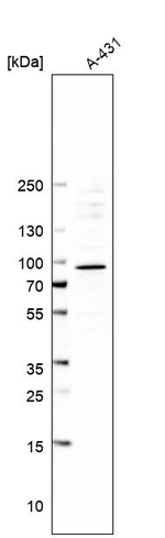 SFMBT1 Antibody in Western Blot (WB)