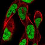 RSF1 Polyclonal Antibody