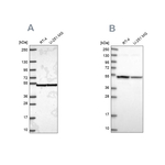 Importin 4 Antibody in Western Blot (WB)