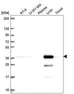 AKR7A2 Antibody in Western Blot (WB)