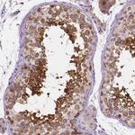 SSSCA1 Polyclonal Antibody