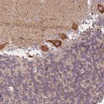 HS3ST5 Polyclonal Antibody