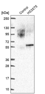 HS3ST5 Antibody in Western Blot (WB)
