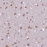 GAS7 Antibody in Immunohistochemistry (Paraffin) (IHC (P))