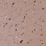 Synphilin 1 Antibody in Immunohistochemistry (Paraffin) (IHC (P))