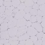 SCML2 Polyclonal Antibody