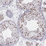 SCML2 Antibody in Immunohistochemistry (Paraffin) (IHC (P))