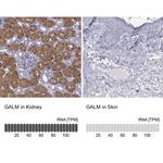 GALM Antibody