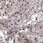 GALM Antibody in Immunohistochemistry (Paraffin) (IHC (P))