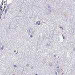 GALM Antibody in Immunohistochemistry (Paraffin) (IHC (P))