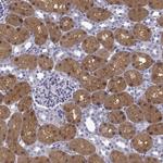 GALM Antibody in Immunohistochemistry (Paraffin) (IHC (P))