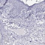 GALM Antibody in Immunohistochemistry (Paraffin) (IHC (P))