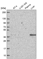 GALM Antibody in Western Blot (WB)