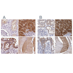 UGP2 Antibody in Immunohistochemistry (Paraffin) (IHC (P))