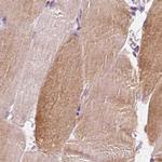 UGP2 Antibody in Immunohistochemistry (Paraffin) (IHC (P))