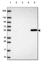UGP2 Antibody in Western Blot (WB)