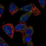 ACOX2 Polyclonal Antibody