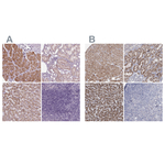 ACOX2 Antibody in Immunohistochemistry (Paraffin) (IHC (P))