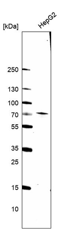 ACOX2 Antibody in Western Blot (WB)