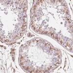 Prosapip2 Polyclonal Antibody