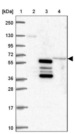 Prosapip2 Antibody in Western Blot (WB)