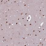 Aprataxin Antibody in Immunohistochemistry (Paraffin) (IHC (P))