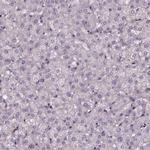 AEBP1 Antibody in Immunohistochemistry (Paraffin) (IHC (P))