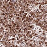 AEBP1 Antibody in Immunohistochemistry (Paraffin) (IHC (P))