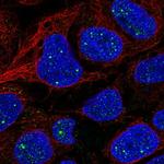 AMER1 Polyclonal Antibody