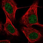 KRBOX4 Polyclonal Antibody