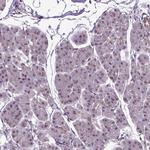 UBA3 Antibody in Immunohistochemistry (Paraffin) (IHC (P))