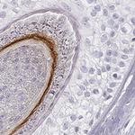 KRT72 Polyclonal Antibody